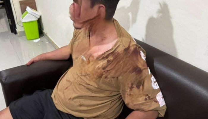 Berharap Mendapat Keadilan Pasca Dipukul Hingga Mandi Darah.